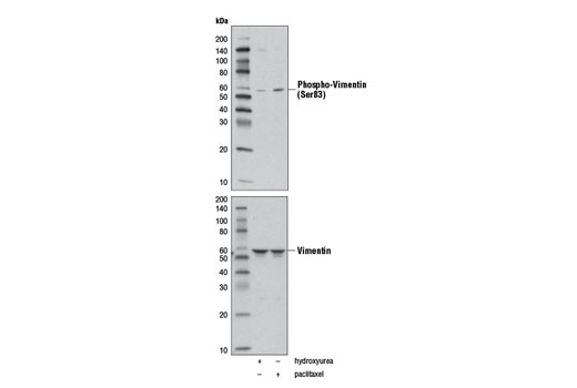 Western Blotting Image 1: Phospho-Vimentin (Ser83) (D5A2D) Rabbit mAb