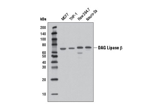 Western Blotting Image 1: DAG Lipase β (D4P7C) Rabbit mAb