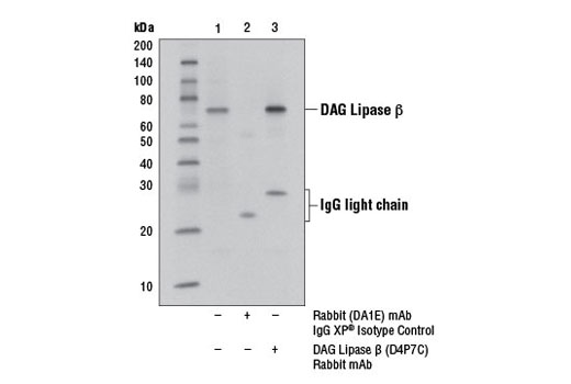 Immunoprecipitation Image 1: DAG Lipase β (D4P7C) Rabbit mAb