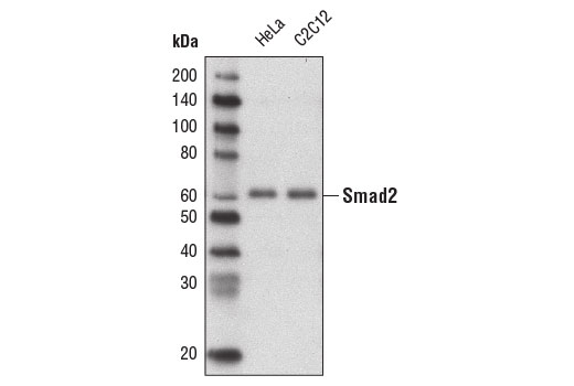 Western Blotting Image 1: Smad2 (D43B4) XP® Rabbit mAb (Biotinylated) 