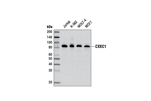 Western Blotting Image 1: CXXC1 Antibody