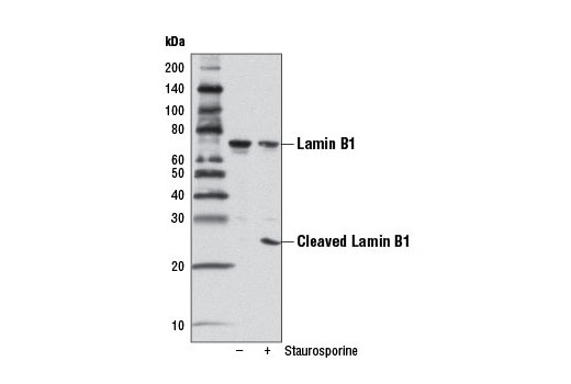  Image 15: Effector Caspases and Substrates Antibody Sampler Kit