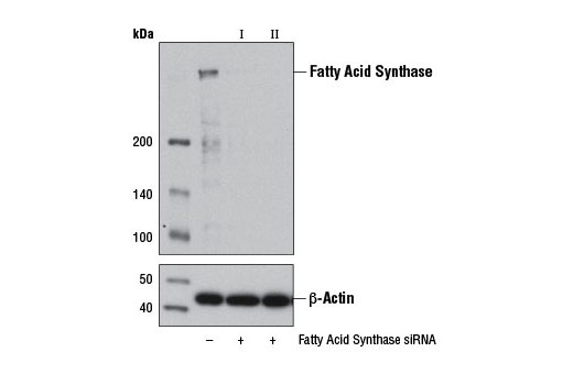 Image 1: SignalSilence® Fatty Acid Synthase siRNA I