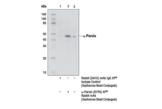 Immunoprecipitation Image 1: α-Parvin (D7F9) XP® Rabbit mAb (Sepharose® Bead Conjugate)
