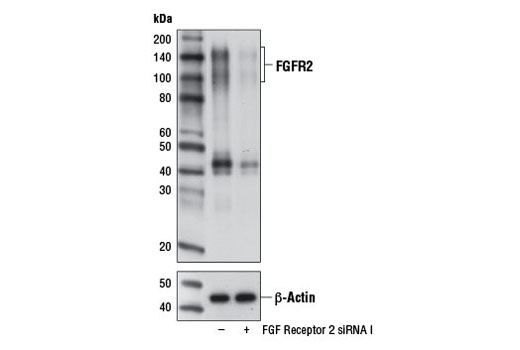  Image 1: SignalSilence® FGF Receptor 2 siRNA I