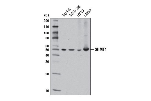 Western Blotting Image 1: SHMT1 Antibody