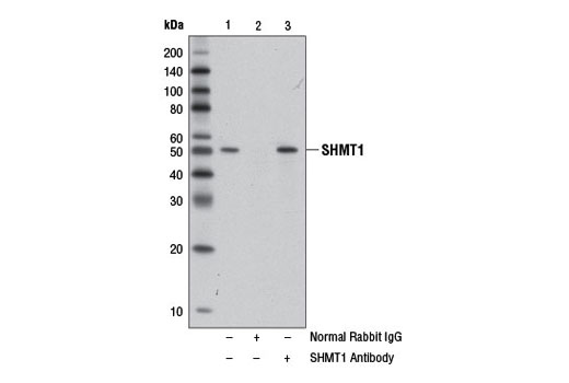 Immunoprecipitation Image 1: SHMT1 Antibody