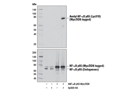  Image 1: NF-κB p65 Antibody Sampler Kit