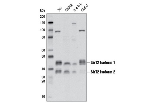  Image 2: Sirtuin Antibody Sampler Kit