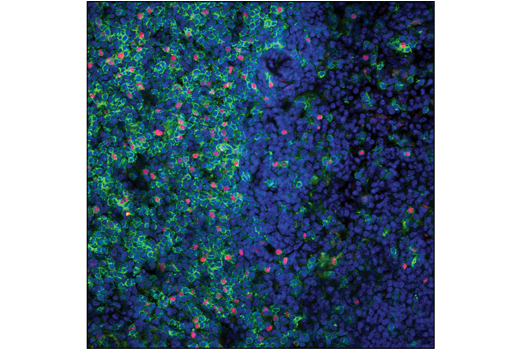  Image 46: Mouse Immune Cell Phenotyping IHC Antibody Sampler Kit