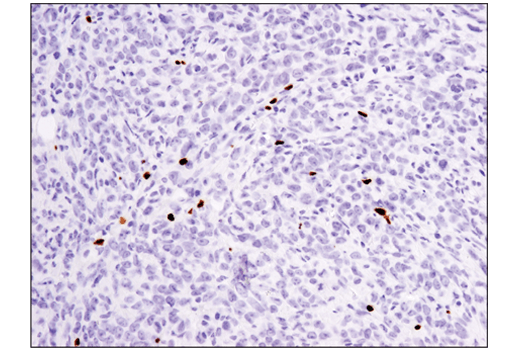 Immunohistochemistry Image 1: FoxP3 (D6O8R) Rabbit mAb