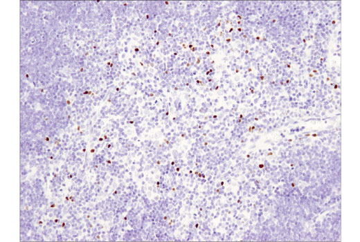 Immunohistochemistry Image 2: FoxP3 (D6O8R) Rabbit mAb