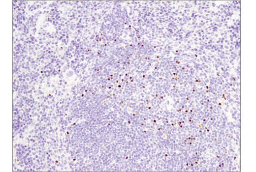 Immunohistochemistry Image 3: FoxP3 (D6O8R) Rabbit mAb
