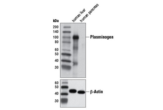 Western Blotting Image 1: Plasminogen Antibody