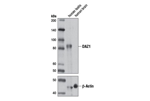 Western Blotting Image 1: DAZ1 Antibody