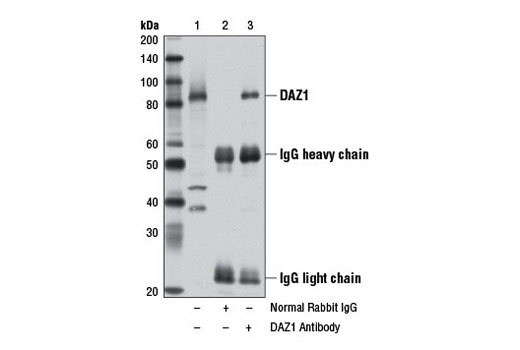 Immunoprecipitation Image 1: DAZ1 Antibody