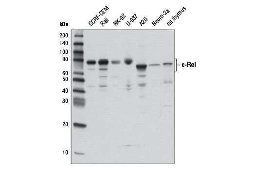  Image 1: c-Oncogene Antibody Sampler Kit