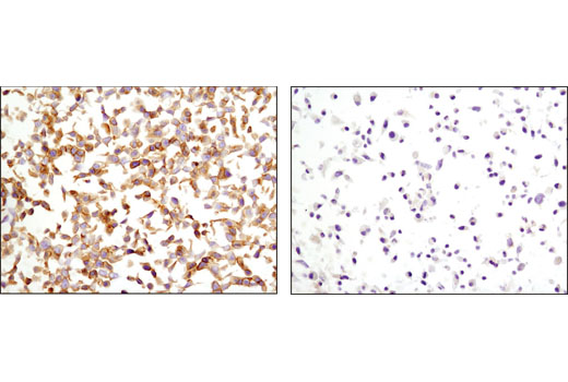 Immunohistochemistry Image 8: HER3/ErbB3 (D22C5) XP® Rabbit mAb (BSA and Azide Free)