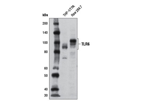  Image 3: Toll-like Receptor Antibody Sampler Kit II