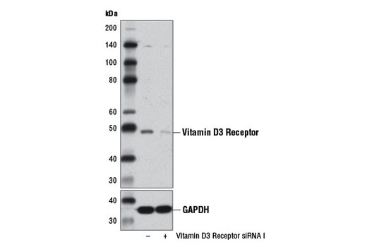  Image 1: SignalSilence® Vitamin D3 Receptor siRNA I