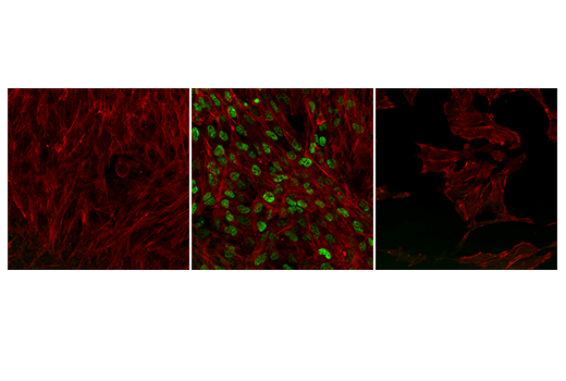 Immunofluorescence Image 1: NRF2 (D1Z9C) XP® Rabbit mAb