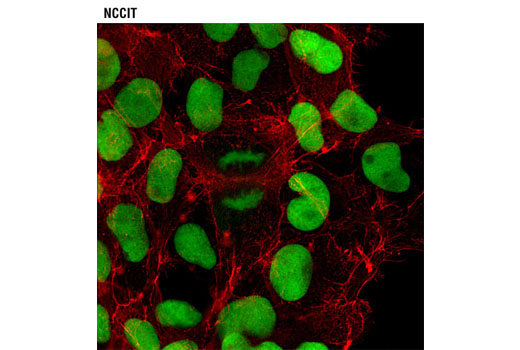 Immunofluorescence Image 1: HMGN1 (D1I5O) Rabbit mAb