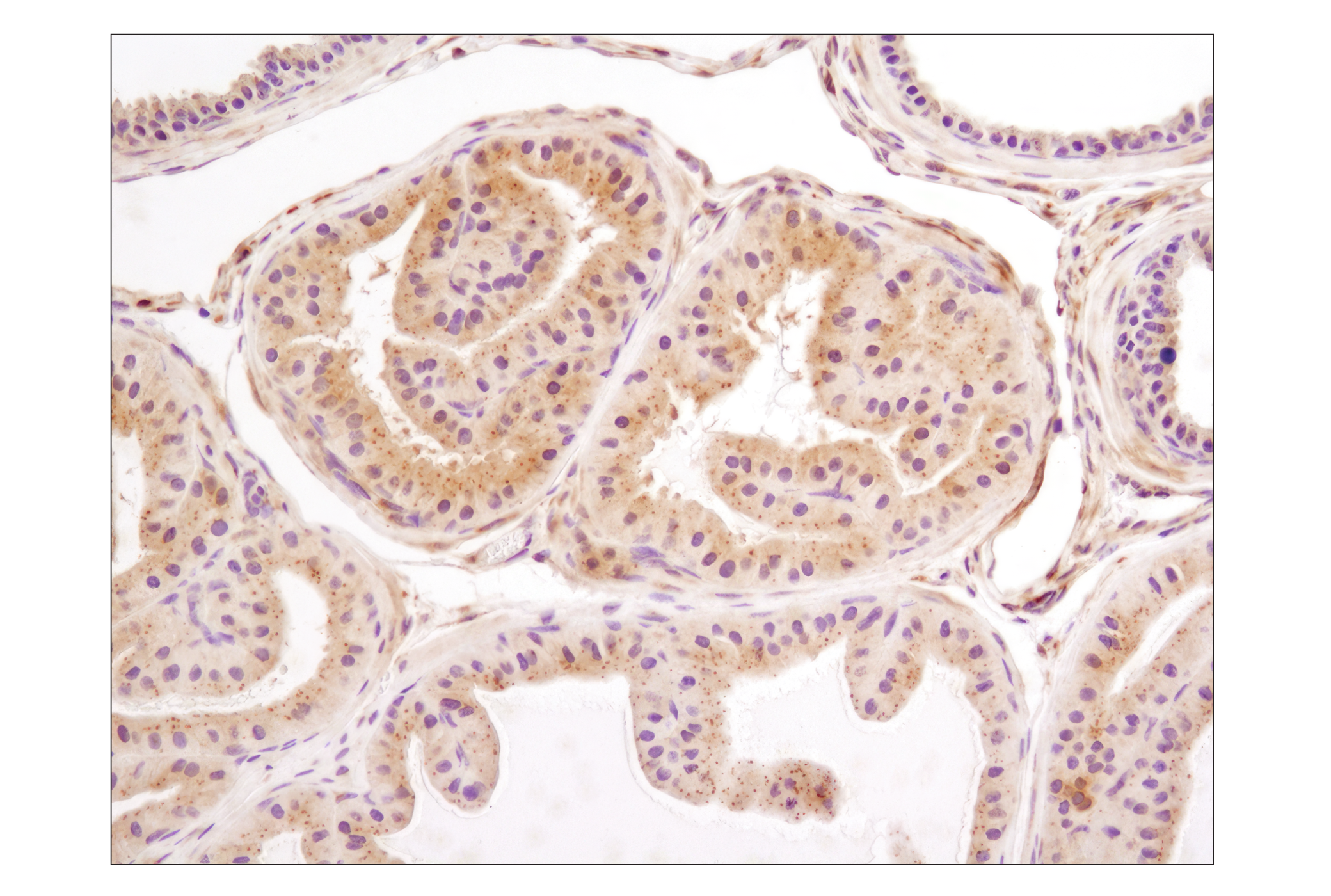  Image 21: p62/KEAP1/NRF2 Pathway Antibody Sampler Kit