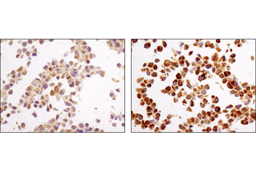  Image 24: p62/KEAP1/NRF2 Pathway Antibody Sampler Kit