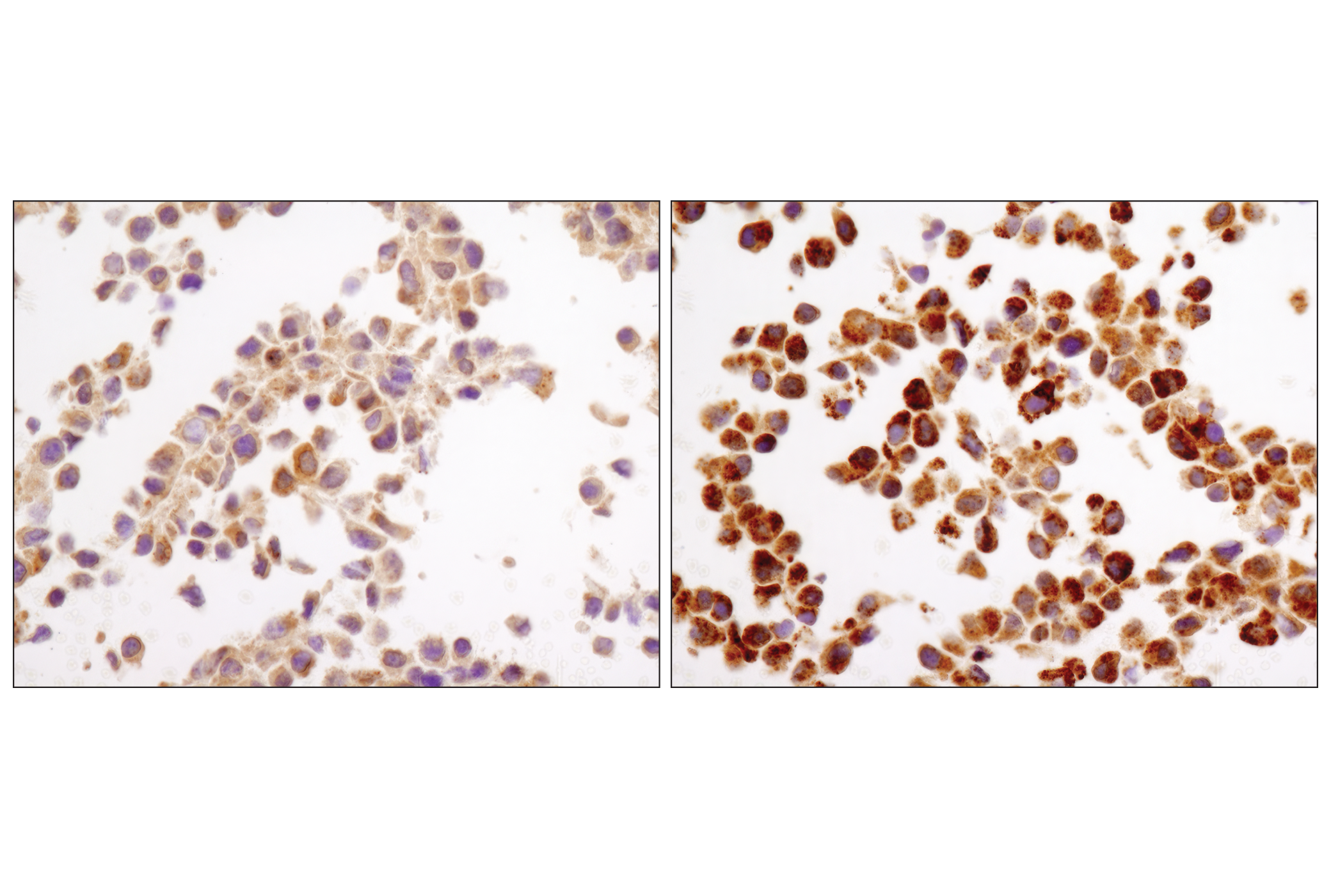 Immunohistochemistry Image 3: LC3A/B (D3U4C) XP® Rabbit mAb
