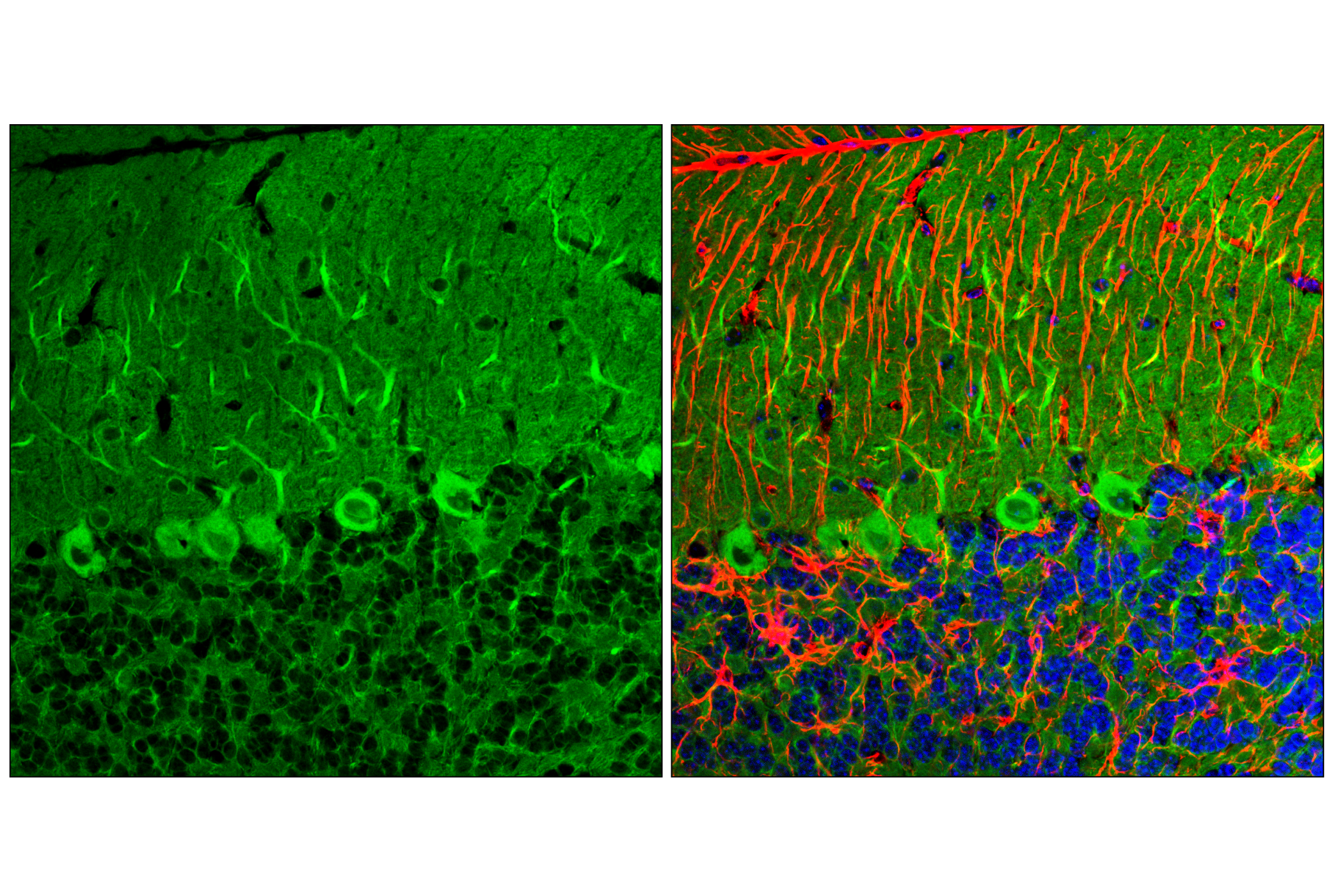 undefined Image 38: p62/KEAP1/NRF2 Pathway Antibody Sampler Kit