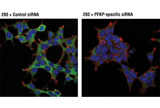 Immunofluorescence Image 1: PFKP (D2E5) Rabbit mAb