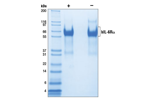  Image 2: Human Interleukin-6 Receptor α (hIL-6Rα)