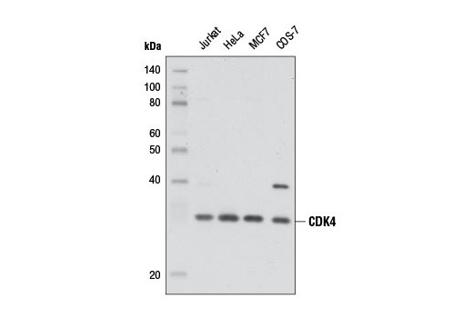  Image 1: CDK Antibody Sampler Kit