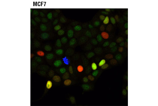 Immunofluorescence Image 1: CDK4 (D9G3E) Rabbit mAb