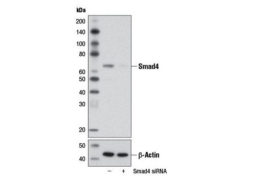  Image 1: SignalSilence® Smad4 siRNA I (Mouse Specific)