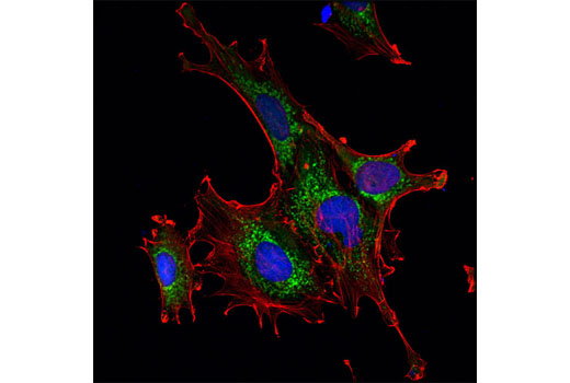 Immunofluorescence Image 1: Glutamate Dehydrogenase 1/2 (D9F7P) Rabbit mAb (BSA and Azide Free)