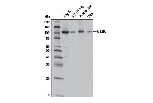 Western Blotting Image 1: GLDC Antibody
