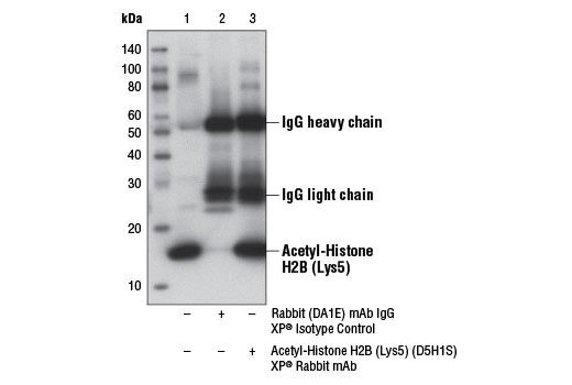 Immunoprecipitation Image 1: Acetyl-Histone H2B (Lys5) (D5H1S) XP® Rabbit mAb
