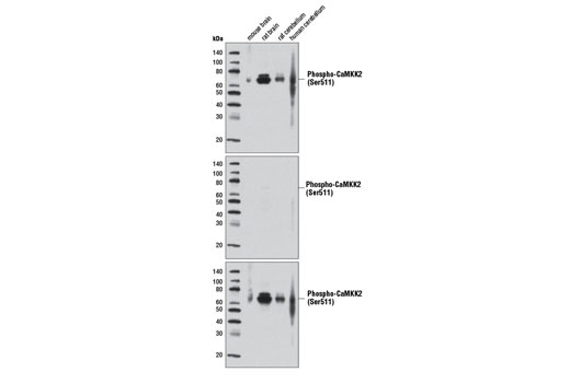 Western Blotting Image 1: Phospho-CaMKK2 (Ser511) Antibody
