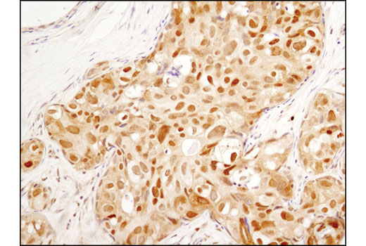 Immunohistochemistry Image 1: FoxO3a (D19A7) Rabbit mAb