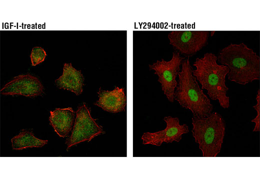 Immunofluorescence Image 1: FoxO3a (D19A7) Rabbit mAb