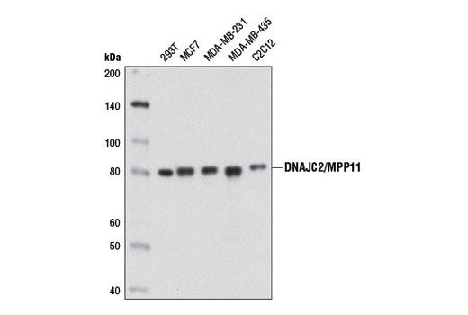 Western Blotting Image 1: DNAJC2/MPP11 (D6B1E) Rabbit mAb