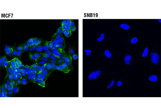 Immunofluorescence Image 1: Rab11FIP1 (D9D8P) Rabbit mAb