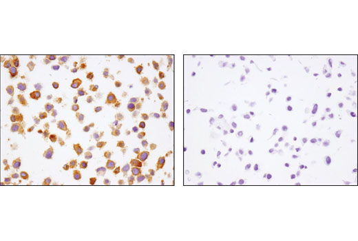 Immunohistochemistry Image 1: β2-microglobulin (D8P1H) Rabbit mAb