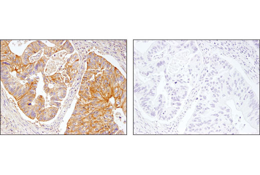 Immunohistochemistry Image 2: β2-microglobulin (D8P1H) Rabbit mAb