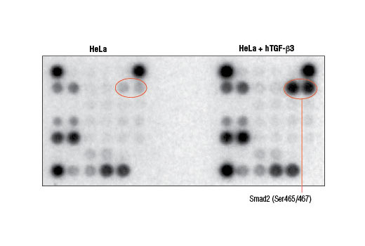  Image 4: PathScan® Stress and Apoptosis Signaling Antibody Array Kit (Chemiluminescent Readout)