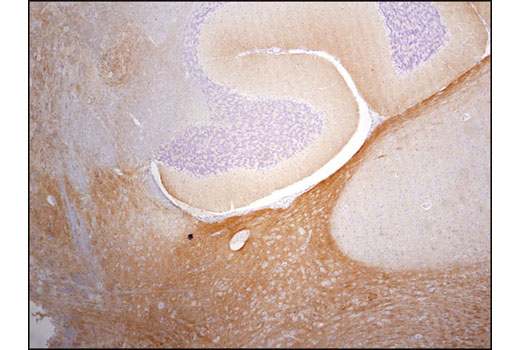  Image 42: Pathological Hallmarks of Alzheimer's Disease Antibody Sampler Kit