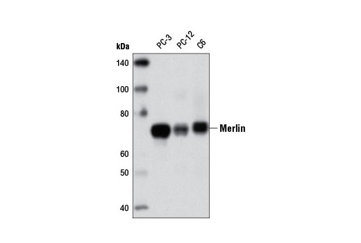 Western Blotting Image 1: Merlin (D6N8H) Rabbit mAb