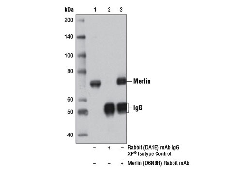 Immunoprecipitation Image 1: Merlin (D6N8H) Rabbit mAb