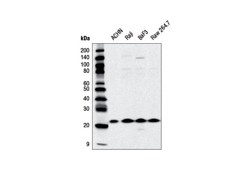 Western Blotting Image 1: CBFβ Antibody
